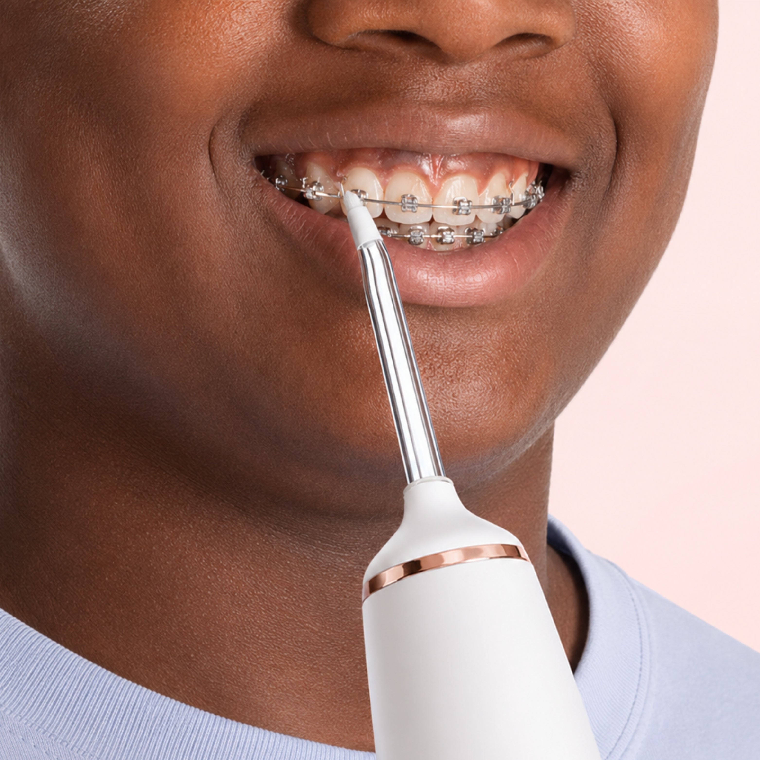 Embout orthodontique NEOPULSE orientant le jet d’eau entre les dents, les bagues et le long des gencives